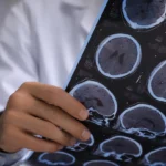 doctor reading brain scan