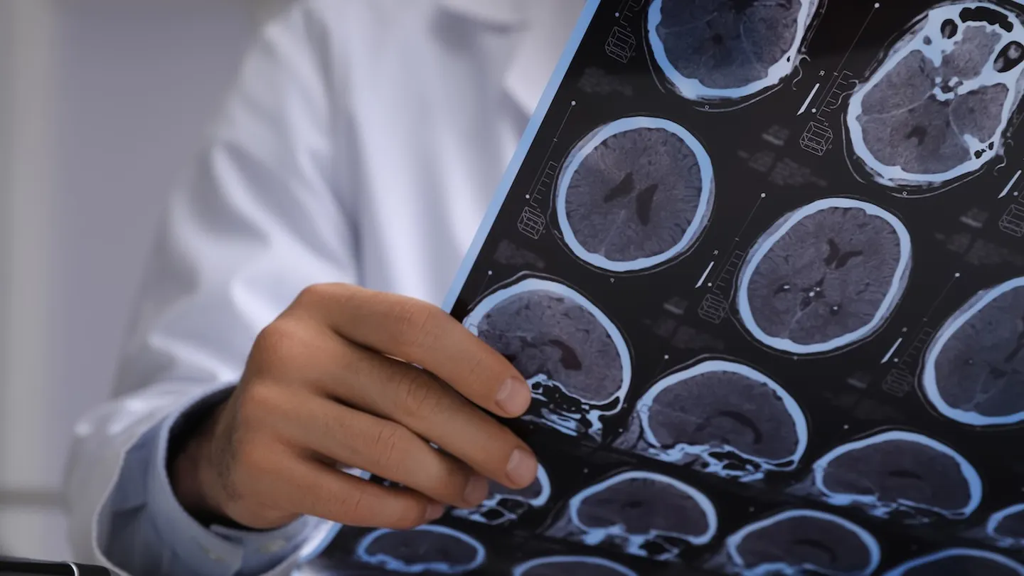 doctor reading brain scan